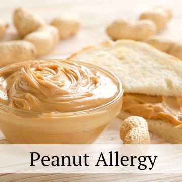 Peanut Allergy